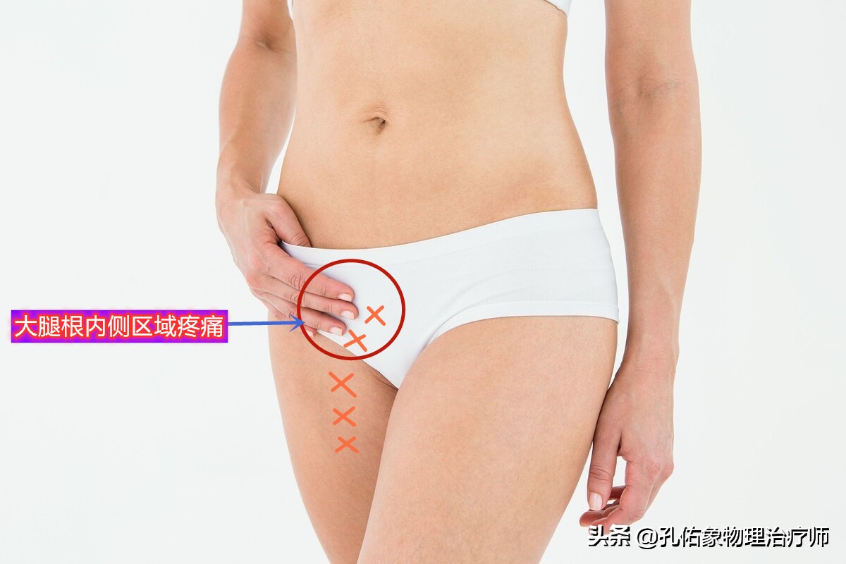 女性为什么大腿根会痛,中年女性大腿内侧疼痛是怎么回事