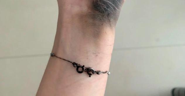 充电器爆炸到底有多可怕,危险充电器保护安全