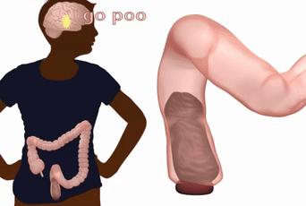 一紧张就想拉屎怎么办,一紧张就想拉屎怎么克服