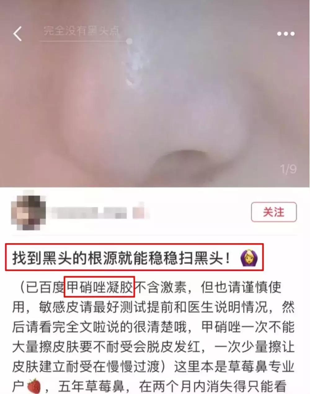 欧阳娜娜擦什么药膏好,欧阳娜娜安利祛疤膏