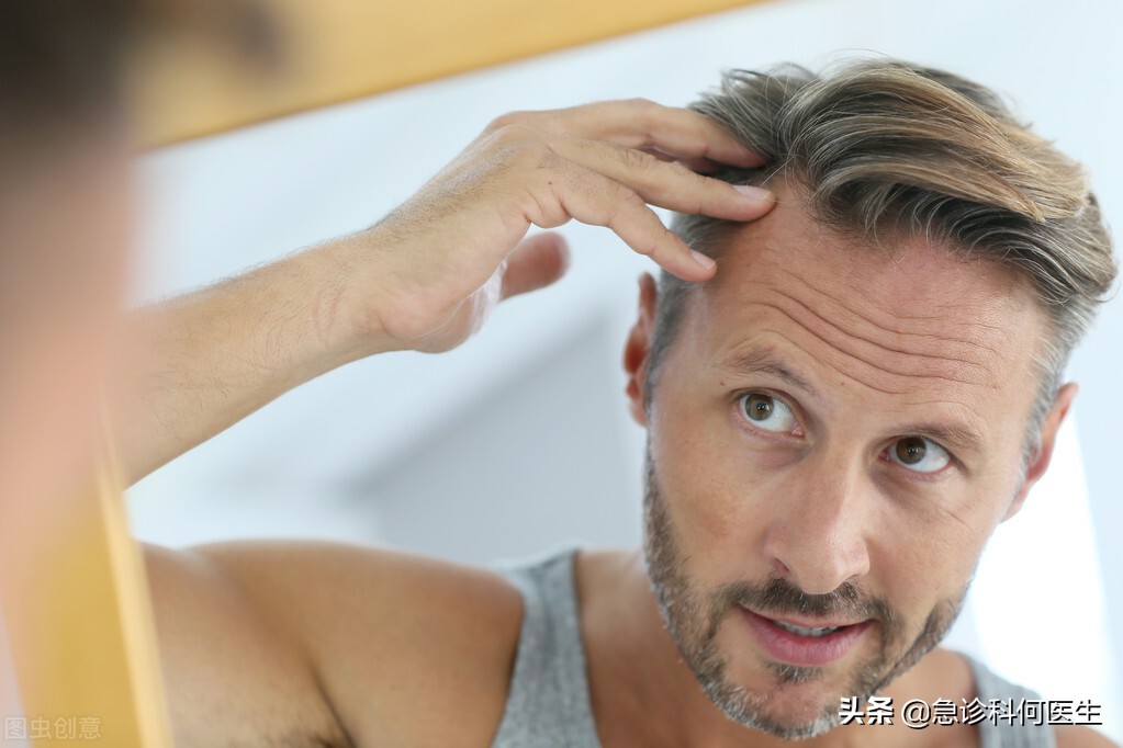 脱发吃非那雄胺效果如何,脱发长期服用非那雄胺可以吗