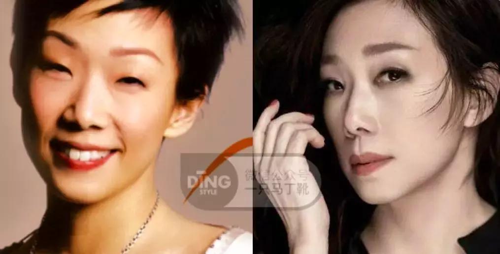 中庭短显年轻还是显老,中庭长怎么避免显老