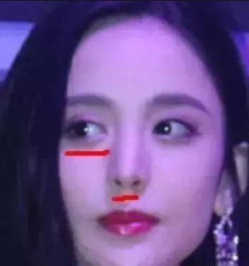 盘点一些有问题的鼻子,明星都没整好的鼻子