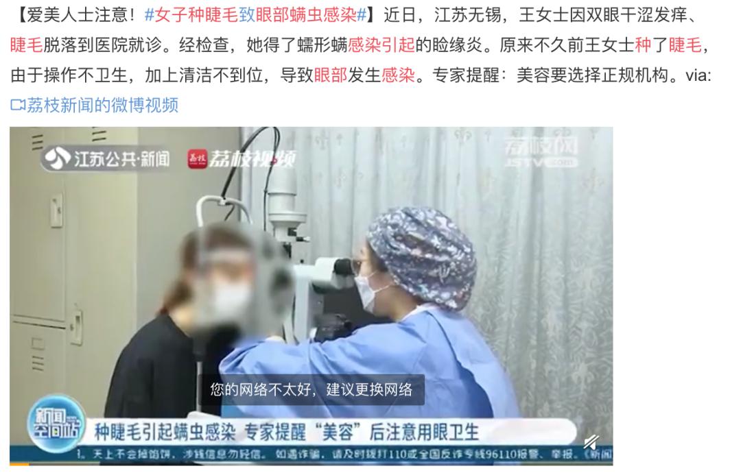 女子眼睛干涩发痒一查竟长满了虫,眼睛生了螨虫怎么治疗