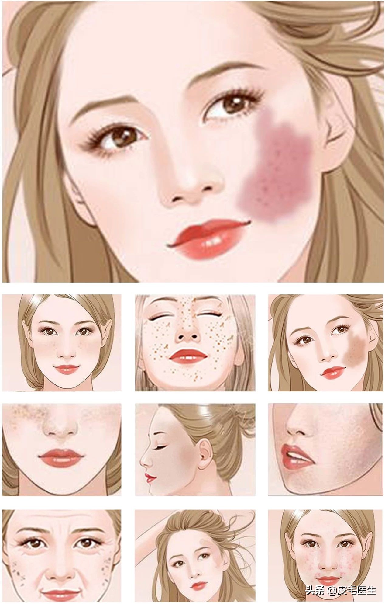 雀斑黄褐斑老年斑祛斑方法,褐斑老年斑怎么治疗效果最好