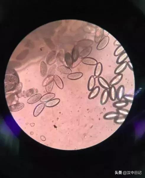 家有女宝的都看看，四岁女童被发现*体下**有虫，还会动