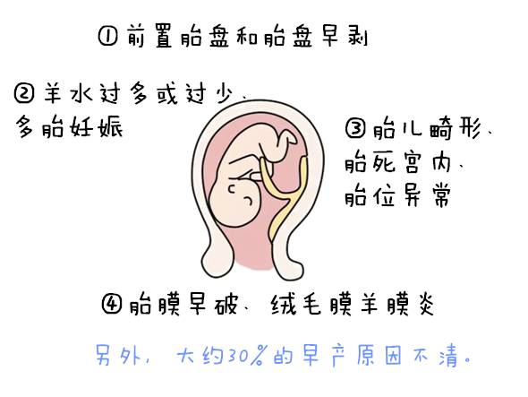 胎儿为什么会有先兆早产的情况,为什么有的孕妇早产有的推迟