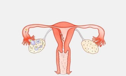 上环后月经会提前或者延后吗,上环后月经推迟一周会不会怀孕