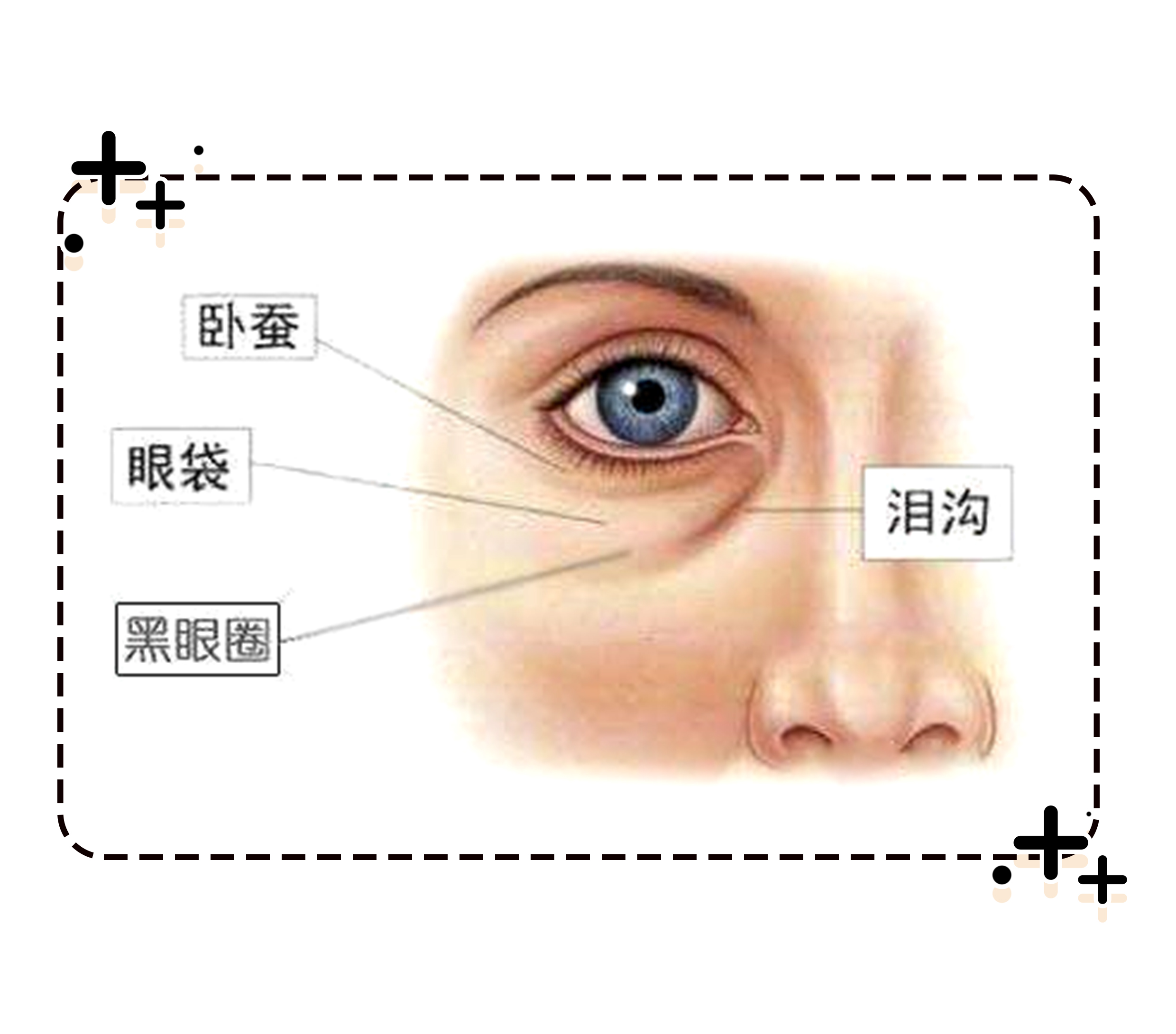 真正的黑眼圈漫画,黑眼圈的十大真相