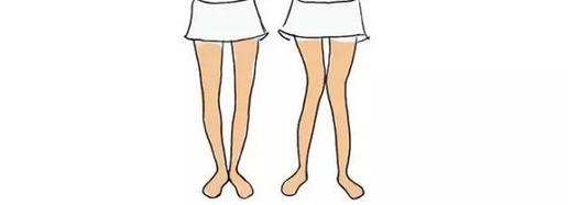 佝偻病是因为缺钙吗,孩子佝偻病是咋回事