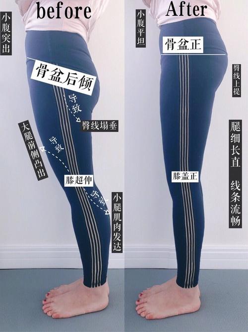 走路久了小腿疼，小腿易浮肿，试试这个方法