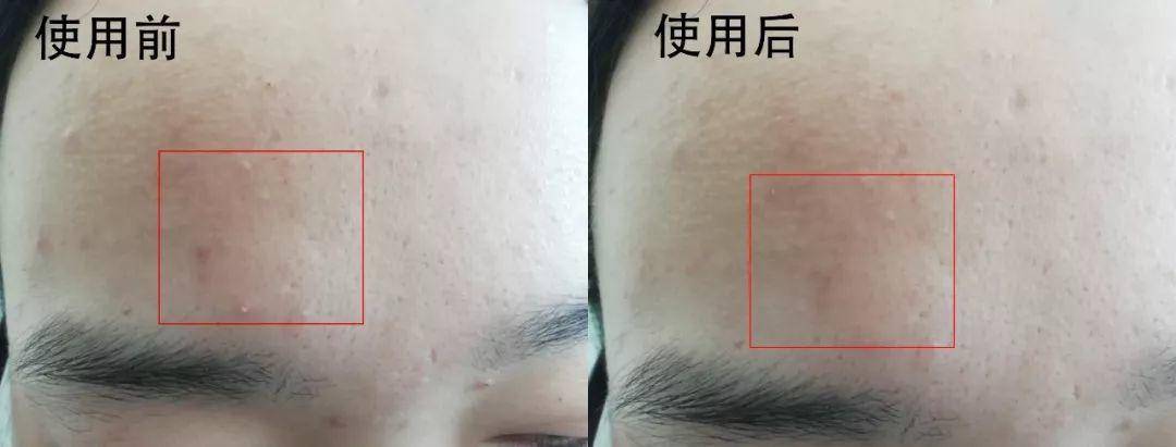 保湿补水霜片仔癀,片仔癀补水防晒