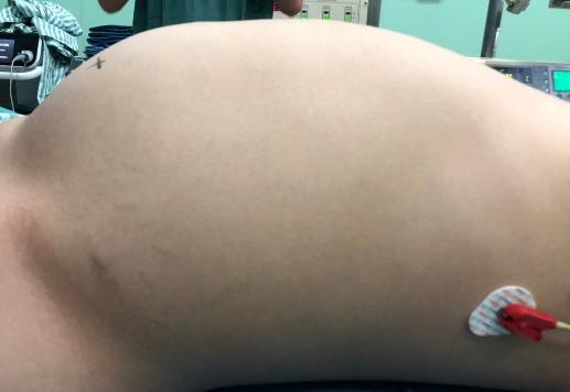 一个普通女孩的15年的变化,瘦了八十斤的亲身经历