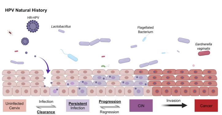 不检查hpv能直接打宫颈癌疫苗吗,用不用去查hpv