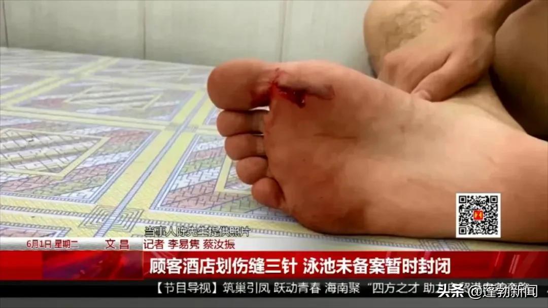 在游泳馆被泳池划伤,酒店游泳池被玻璃划伤