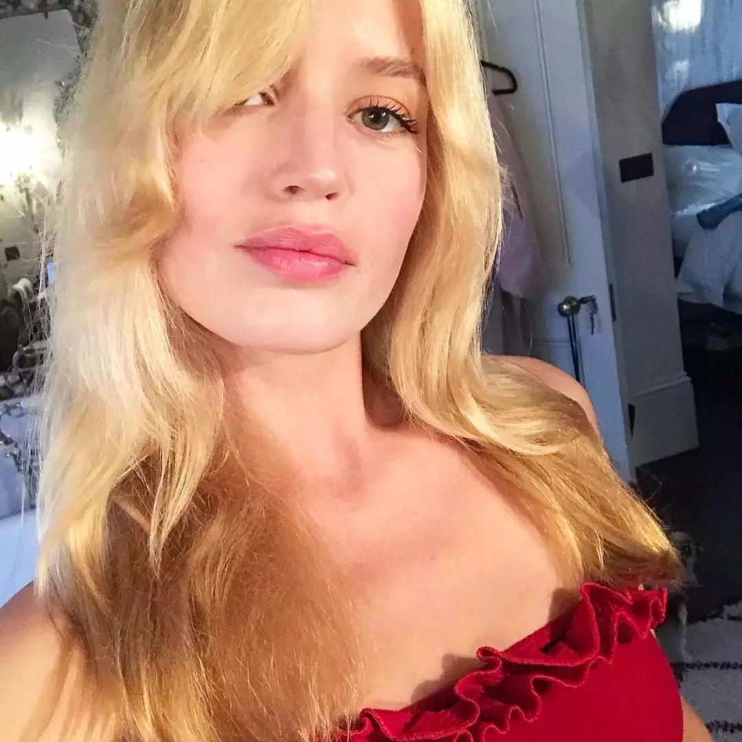 假期过后祛痘,假期祛痘攻略