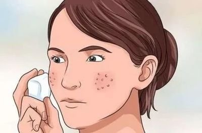 25岁毛孔粗大用什么补水,25岁毛孔粗大暗沉用的精华