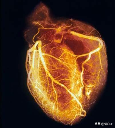 马拉松心梗猝死,马拉松心脏猝死的抢救