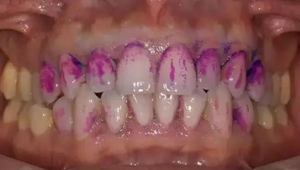 月子牙刷好用吗,月子牙刷好用么