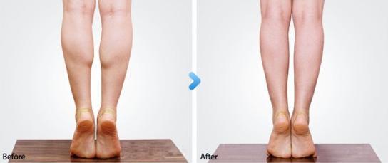 小腿粗怎么办？拉伸准没错~经典瘦小腿拉伸动作，每天拉伸瘦小腿