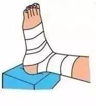 脚踝扭伤恢复时间表,脚踝扭伤已经恢复的诊断证明