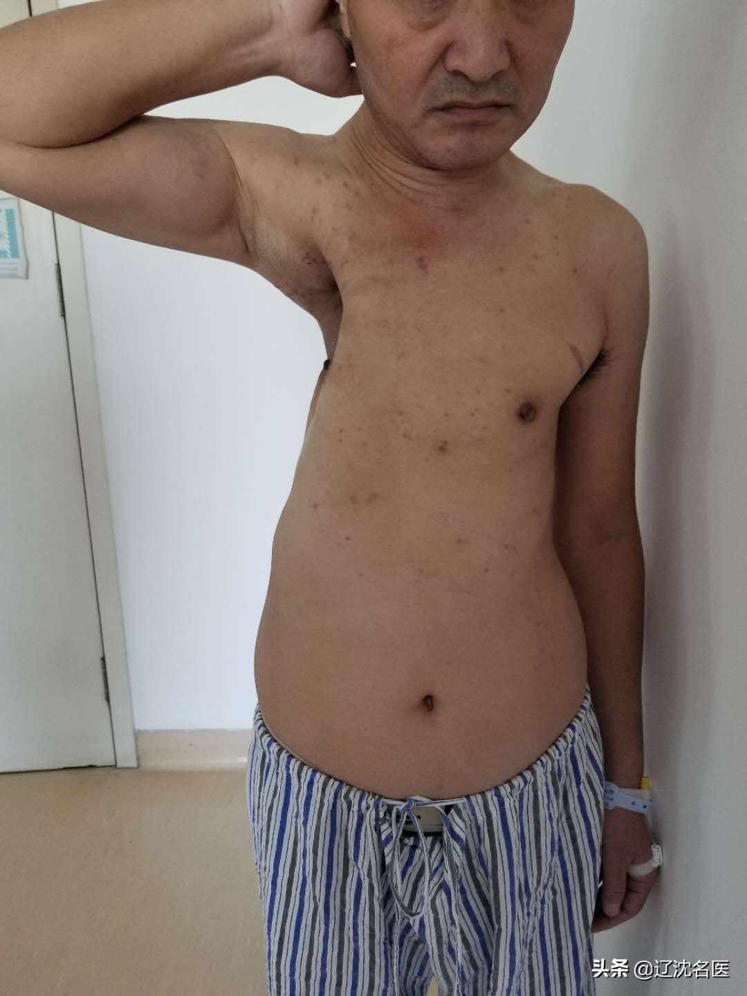 男人被病痛折磨20年,男子被病魔折磨10年