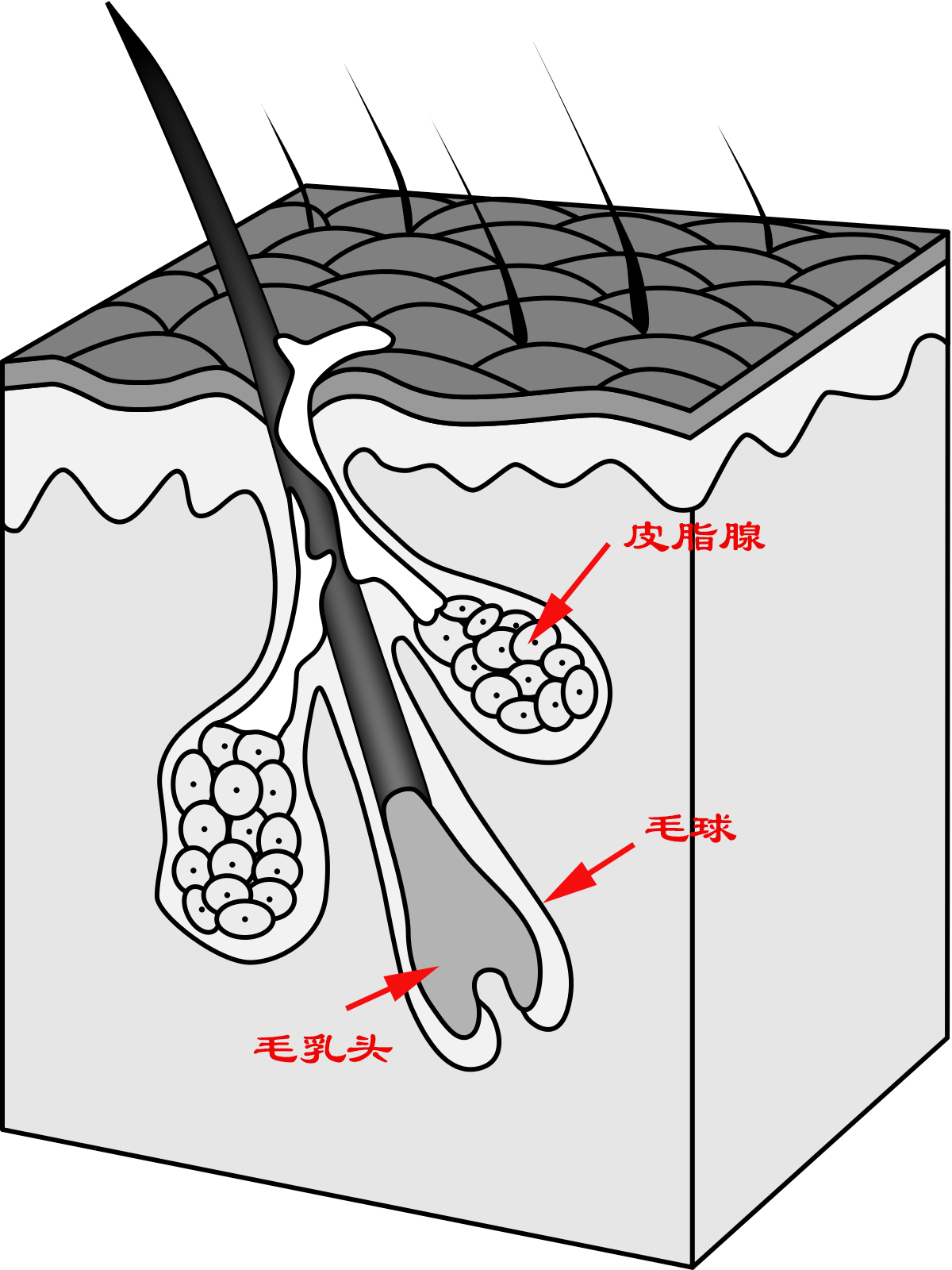 中年男性脱发原因及治疗方法,中年男性遗传性脱发能治好吗