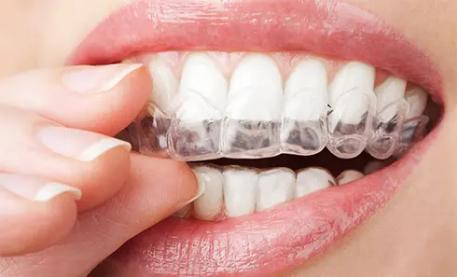 想整牙害怕有牙套脸,想整牙又害怕