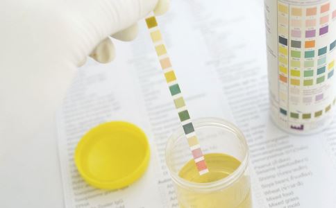 晨起尿黄和肝有关系吗,入职体检尿胆红素阳性是怎么回事