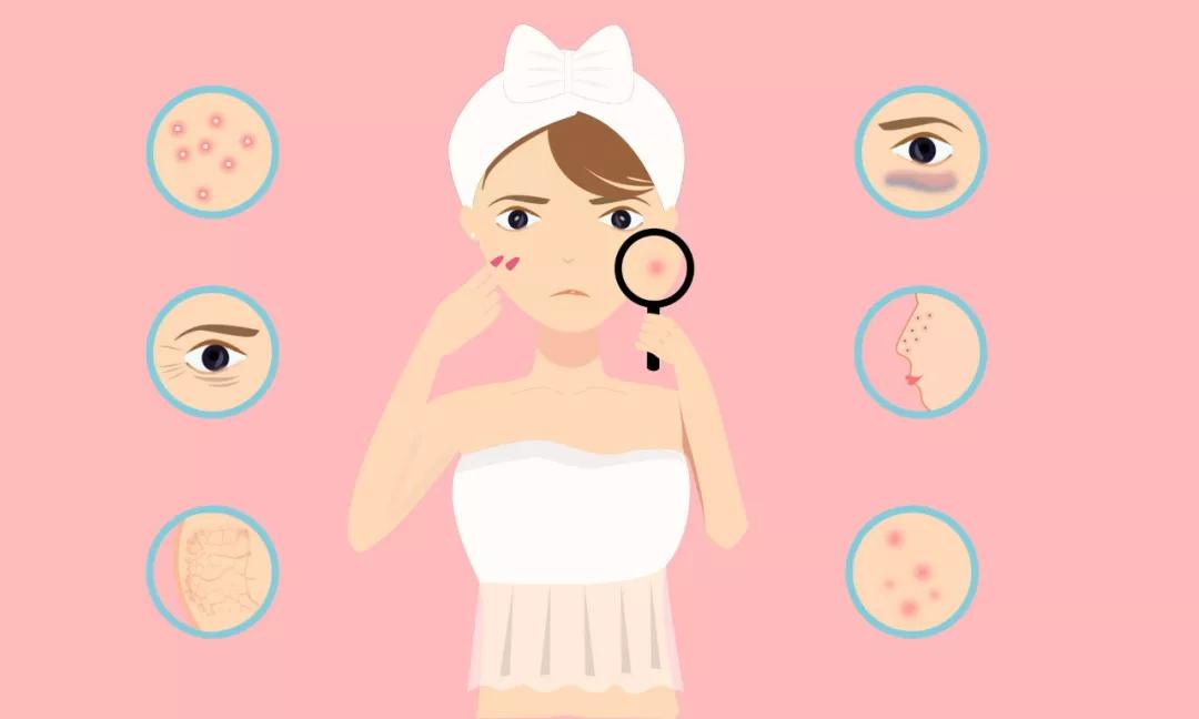 甲硝唑胶囊能治玫瑰痤疮吗,玫芦消痤膏和甲硝唑凝胶区别