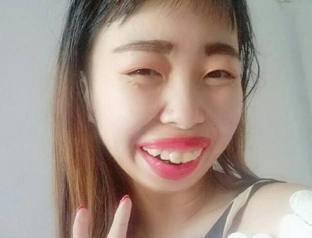 孩子牙齿长歪了松动的不掉,乳牙牙槽骨小恒牙大长不正怎么办