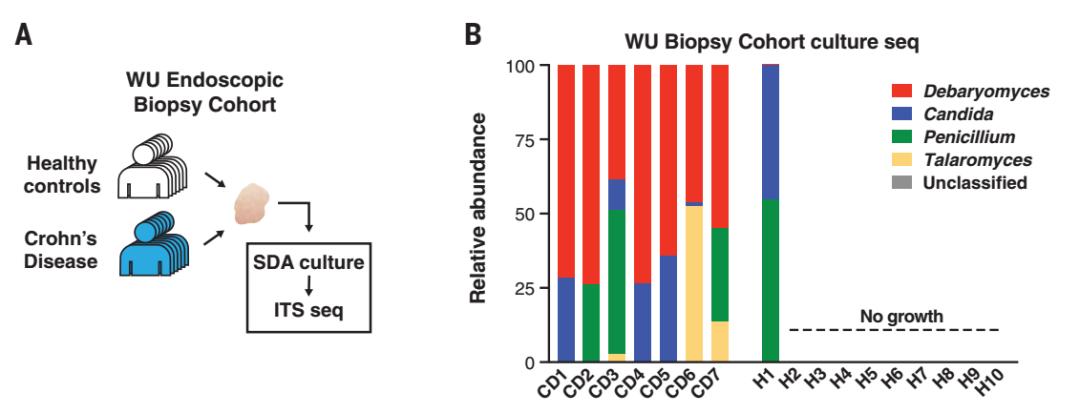 奶酪可以改善肠道吗,奶酪里有酵母菌