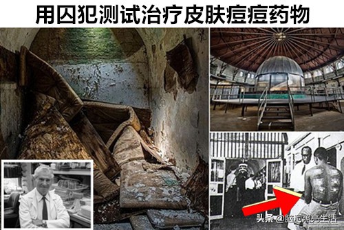 十大灭绝人性的人体实验,历史上最恐怖五项人体实验