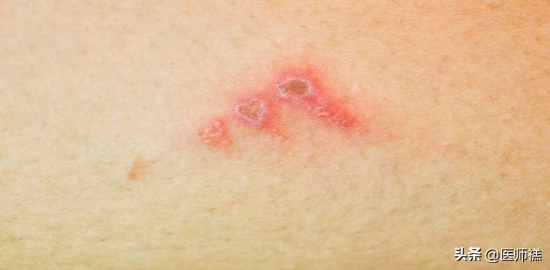 延时*剂喷**到底靠不靠谱,意外怀孕是否对胎儿发育不利?