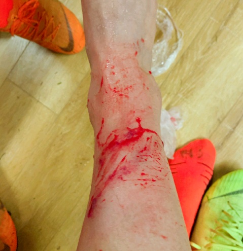 濂宠冻澶哄啝鐢疯冻涓嶈寰楃緸鎰у悧,鐢疯冻缇炴劎