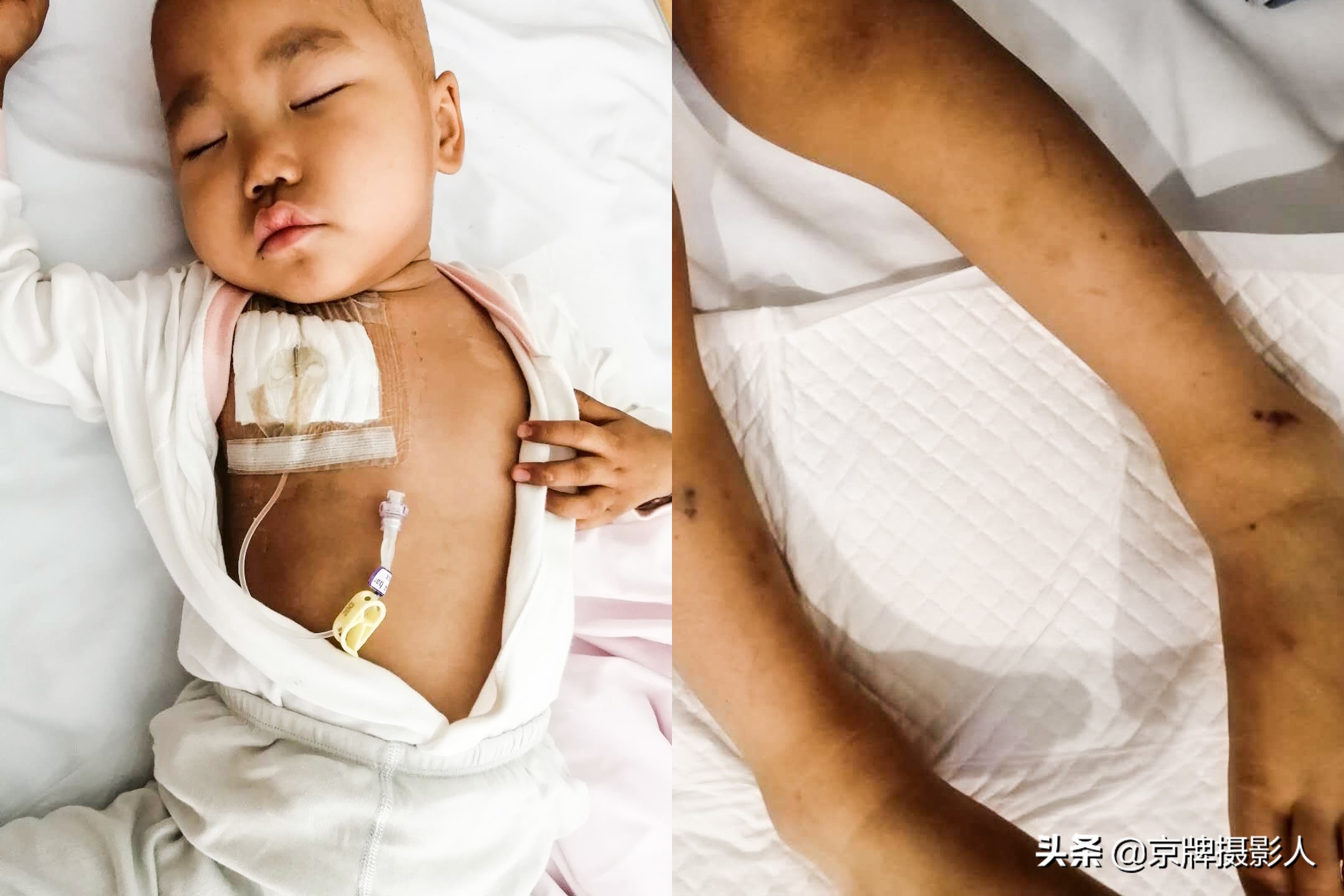 女子瞒丈夫怀孕21周遭引产，丈夫：“一个垂危，再一个咋养？”