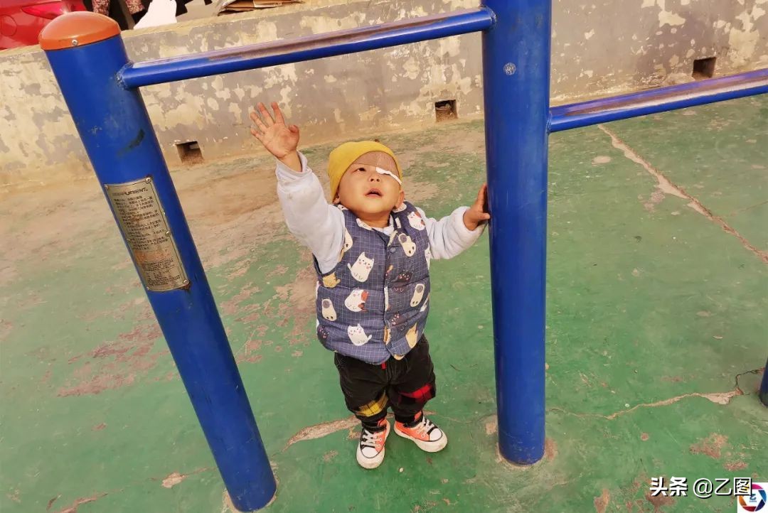 世上最悲催的婴儿,人间悲惨的孩子