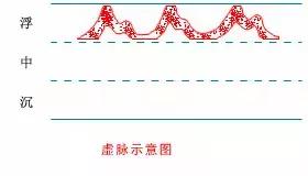 中医把脉自学教程脉象虚,把脉自己学会