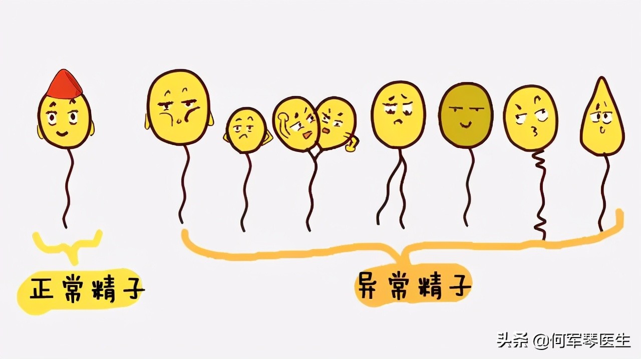 不孕常规检查有哪些,不良妊娠后需要查精子吗