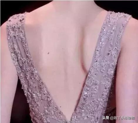 翼型肩胛骨怎么改善体态,瘦出来的蝴蝶骨是翼状肩胛吗