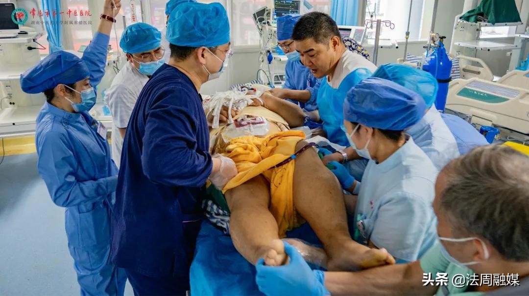 救命神器ecmo哪些医院有,重症病人救命神器