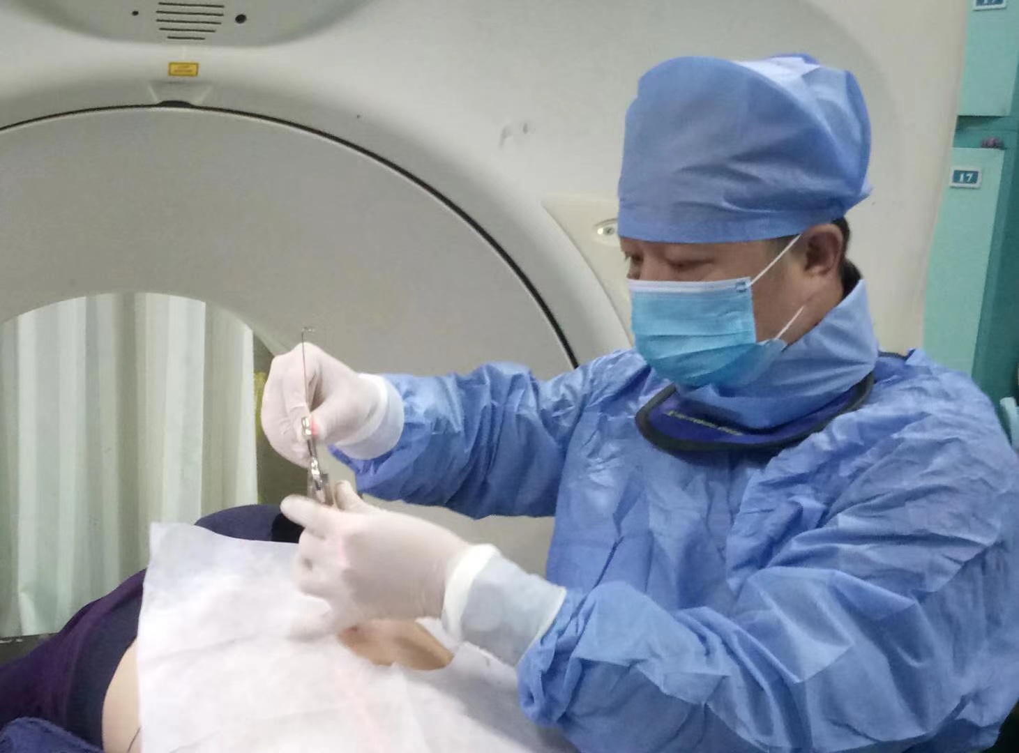 多处转移、无法手术的肺鳞癌患者被沈阳六院的一颗粒子治愈了