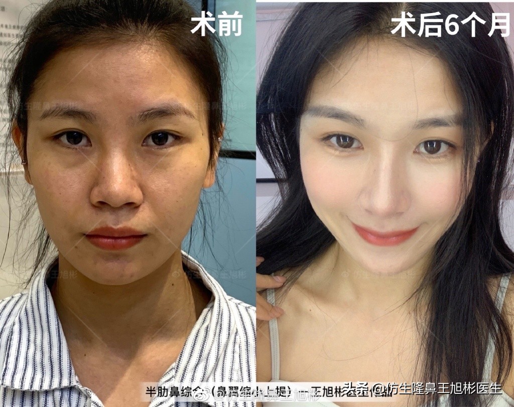 被鼻子封印的颜值,那些被鼻子封印的颜值