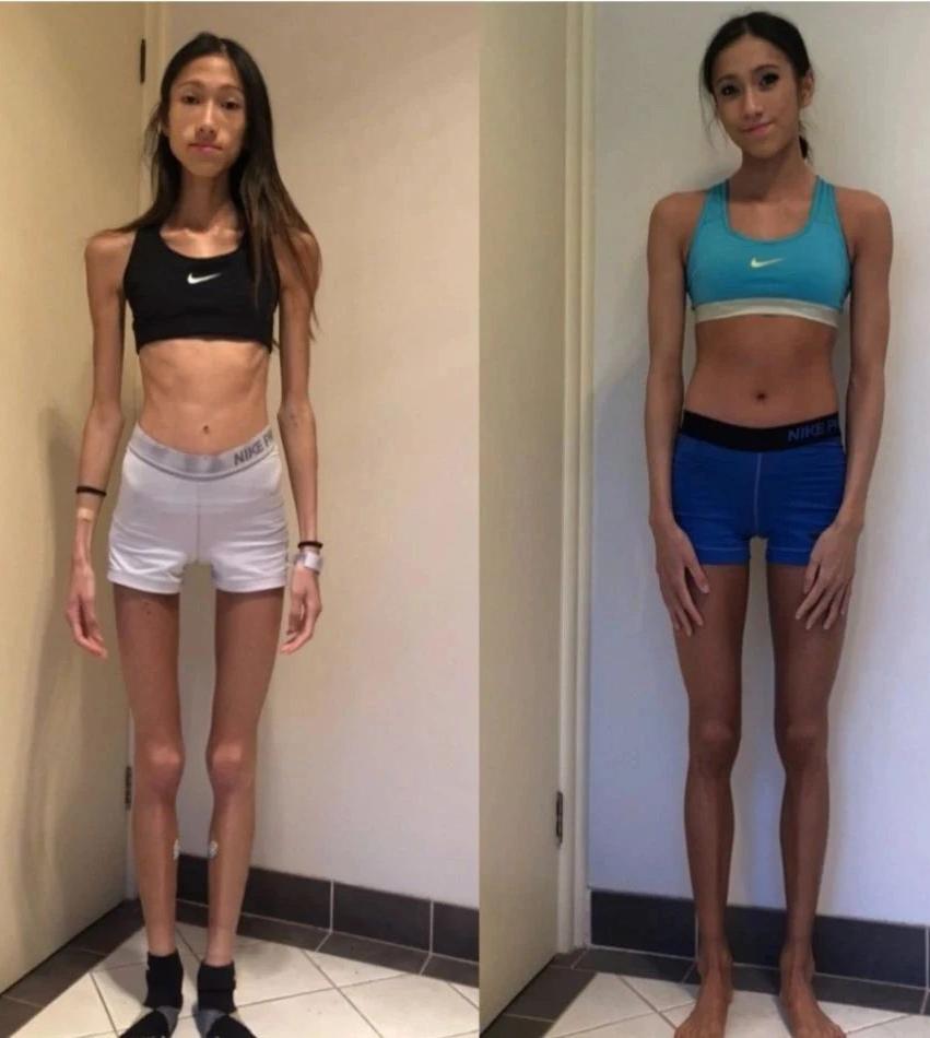 经常性的暴饮暴食会造成什么后果,长期暴饮暴食会引起什么不良后果