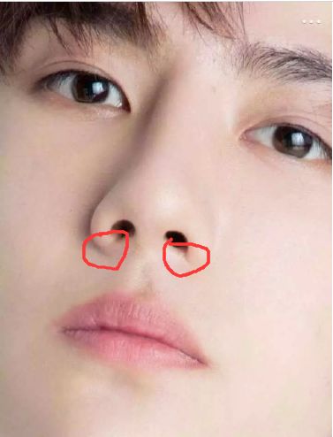 盘点一些有问题的鼻子,明星都没整好的鼻子