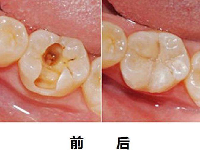 关于开口腔门诊的知识,带您一分钟了解诊所
