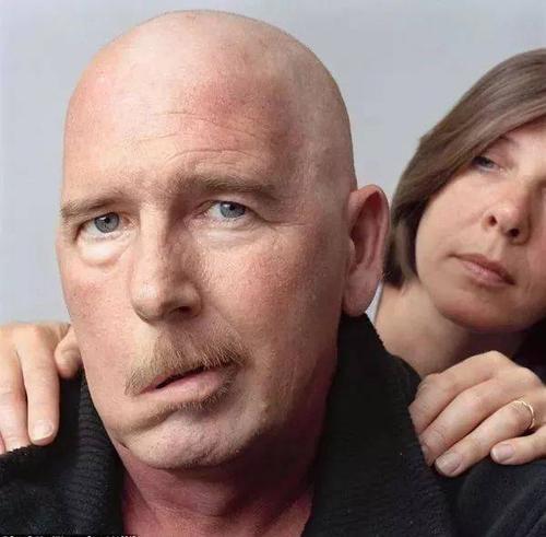 24岁小伙熬夜,24小伙熬夜玩手差点瘫痪