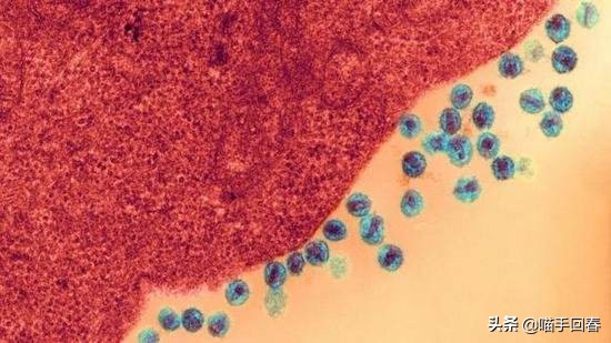 猫会传染艾滋病给人吗,艾滋猫是怎么回事