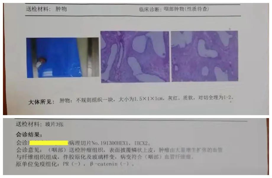 病例分析呼吸,病例13