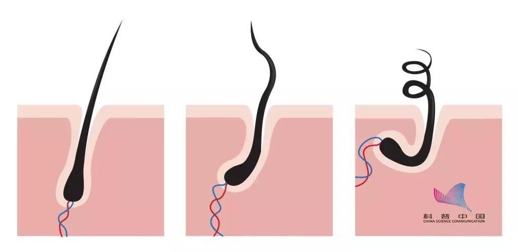 一天掉多少头发才算是脱发,一天掉多少根头发算严重脱发